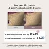 haruharu Wonder Black Rice Hyaluronic Toner for Sensitive Skin, Alcohol Free, Fragrance Free, Deep Hydration, Glass Skin, Korean Skincare, Vegan, Cruelty-Free, 10.1 fl.oz(5.1 fl. oz (Original))